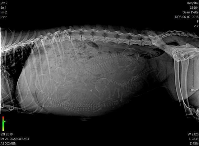 Delta Roka preg xray
