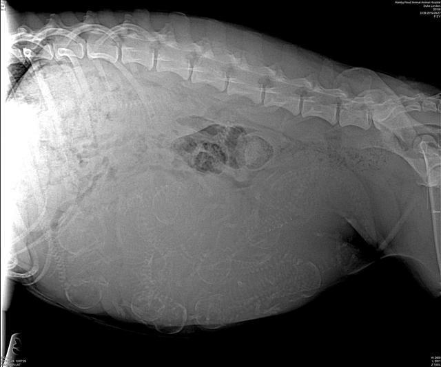 London Raki preg xray 1